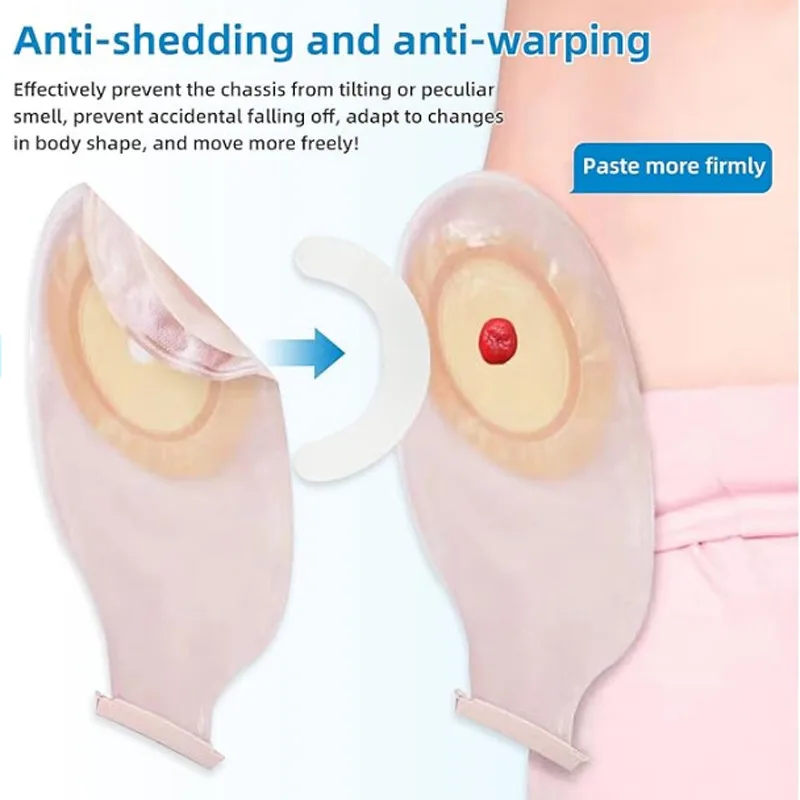 Striscia di Rinforzo per Sacch - Medical Tape recensione e prezzo
